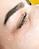 Биоревитализация кожи вокруг глаз Севастополь объявление с фото